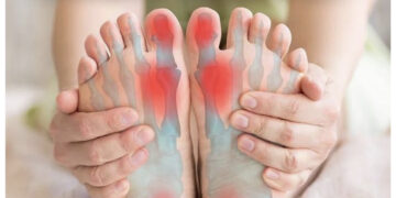 โรครองช้ำ อาการปวดซ้ำ ๆ คล้ายของแหลมทิ่มที่ฝ่าเท้า
